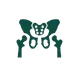 Osteonecrose