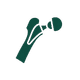 Artroplastia