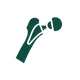 Artroplastia