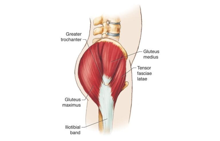 Ilustração da lateral do quadril com o glúteo médio, o tensor da fáscia lata e a banda iliotibial, estruturas ligadas à dor lateral.