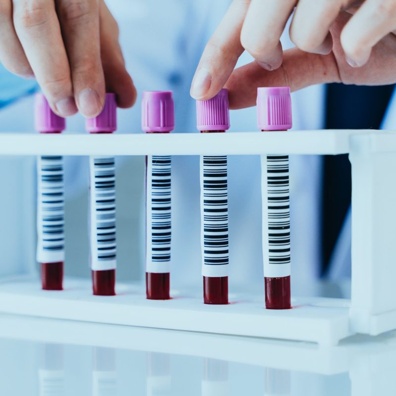 Hands of a lab technician with blood test sample tubes in a row for laboratory blood analysis Hands of a lab technician with blood test sample tubes in a row for laboratory blood analysis.